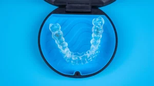 Lire la suite à propos de l’article Invisalign vs Alternatives: Comparatif des Aligneurs en Suisse