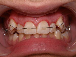 Technique orthodontique geneve