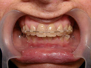 Molder-adulte-geneve