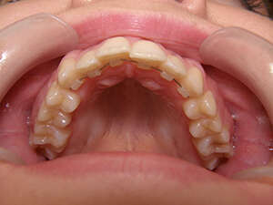 Molders adulte face interne Genève