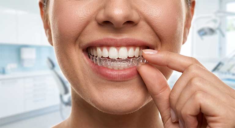 Orthodontie Genève - traitements OrthoLight rue du Rhône